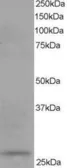 Anti-DCXR antibody, C-term used in Western Blot (WB). GTX11800