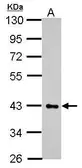 Anti-HS3ST2 antibody used in Western Blot (WB). GTX118041