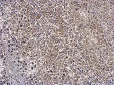 Anti-OAS3 antibody used in IHC (Paraffin sections) (IHC-P). GTX118059