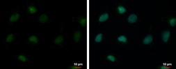 Anti-USP26 antibody [C2C3], C-term used in Immunocytochemistry/ Immunofluorescence (ICC/IF). GTX118119