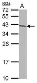 Anti-ARMC1 antibody [N1C2] used in Western Blot (WB). GTX118227