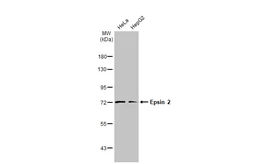 Anti-Epsin 2 antibody [N1C1] used in Western Blot (WB). GTX118330