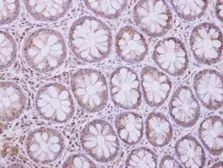 Anti-TRIM29 antibody [N3C3] used in IHC (Paraffin sections) (IHC-P). GTX118367