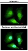 Anti-ADI1 antibody used in Immunocytochemistry/ Immunofluorescence (ICC/IF). GTX118578