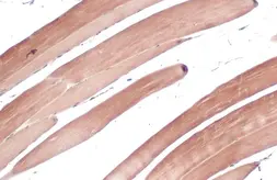 Anti-TRIM72 antibody used in IHC (Paraffin sections) (IHC-P). GTX118625