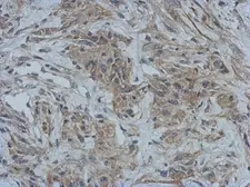 Anti-GBP5 antibody [N3C3] used in IHC (Paraffin sections) (IHC-P). GTX118635