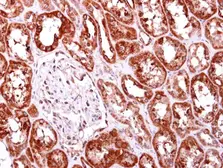 Anti-AIMP2 antibody [N2C3] used in IHC (Paraffin sections) (IHC-P). GTX118650