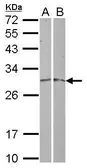 Anti-MRPL19 antibody [N3C3] used in Western Blot (WB). GTX118651