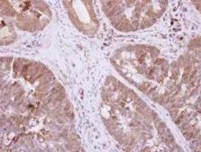 Anti-DIS3L2 antibody [N2C1], Internal used in IHC (Paraffin sections) (IHC-P). GTX118786