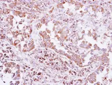 Anti-Pez antibody [N1N2], N-term used in IHC (Paraffin sections) (IHC-P). GTX118862