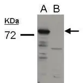 Anti-Influenza A virus PA protein antibody used in Western Blot (WB). GTX118991
