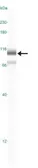 Anti-TNFAIP3 antibody [59A426] used in Western Blot (WB). GTX11900