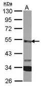 Anti-CPA3 antibody [N3C3] used in Western Blot (WB). GTX119049