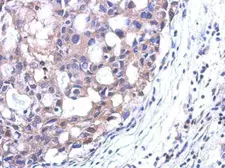 Anti-SRM antibody [N1C2] used in IHC (Paraffin sections) (IHC-P). GTX119072