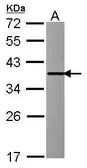 Anti-INMT antibody [N1C3] used in Western Blot (WB). GTX119115