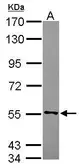 Anti-CYB5R4 antibody [C1C3] used in Western Blot (WB). GTX119151