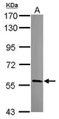 Anti-HECA antibody [C1C3] used in Western Blot (WB). GTX119157