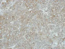 Anti-PCDHGB5 antibody [N1N2], N-term used in IHC (Paraffin sections) (IHC-P). GTX119181