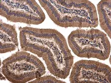 Anti-SPRY4 antibody used in IHC (Paraffin sections) (IHC-P). GTX119230