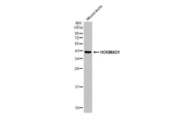 Anti-HORMAD1 antibody [N2C2], Internal used in Western Blot (WB). GTX119236