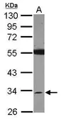 Anti-SDR16C5 antibody [N1C3] used in Western Blot (WB). GTX119280