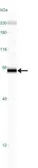 Anti-DR4 antibody [32A1380] used in Western Blot (WB). GTX11931