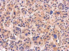 Anti-NTAN1 antibody [N1C3] used in IHC (Paraffin sections) (IHC-P). GTX119378