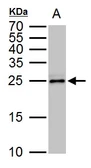 Anti-TPPP antibody [N1C3] used in Western Blot (WB). GTX119520