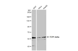 Anti-TCP1 delta antibody [N1C2] used in Western Blot (WB). GTX119638