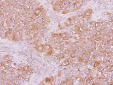 Anti-ARHGAP15 antibody [N1N3] used in IHC (Paraffin sections) (IHC-P). GTX119660