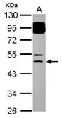 Anti-BTBD6 antibody [N2C2], Internal used in Western Blot (WB). GTX119712