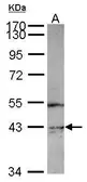 Anti-PIP5K2 gamma antibody [N2N3] used in Western Blot (WB). GTX119713