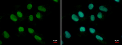 Anti-MEF2B antibody used in Immunocytochemistry/ Immunofluorescence (ICC/IF). GTX119810