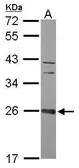 Anti-CCDC90B antibody [N1C2] used in Western Blot (WB). GTX119822