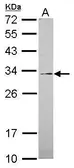 Anti-GALNT12 antibody [C1C3] used in Western Blot (WB). GTX119827