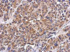 Anti-MRPS26 antibody [N1C3] used in IHC (Paraffin sections) (IHC-P). GTX119878