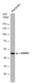 Anti-PABPC5 antibody [N1C2] used in Western Blot (WB). GTX119883