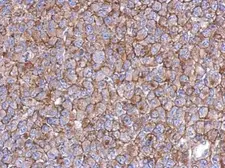 Anti-KIAA0090 antibody [N1N2], N-term used in IHC (Paraffin sections) (IHC-P). GTX119884