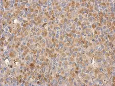 Anti-C18orf34 antibody [N1N2], N-term used in IHC (Paraffin sections) (IHC-P). GTX119924