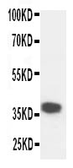 Anti-Kallikrein 5 antibody used in Western Blot (WB). GTX12009