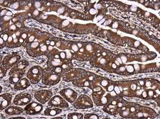 Anti-DYNC1LI1 antibody used in IHC (Paraffin sections) (IHC-P). GTX120114