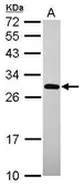 Anti-UNKL antibody [N1N2], N-term used in Western Blot (WB). GTX120163