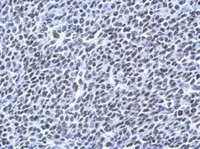 Anti-NPD014 antibody used in IHC (Paraffin sections) (IHC-P). GTX120166