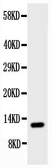 Anti-TFF1 antibody used in Western Blot (WB). GTX12040