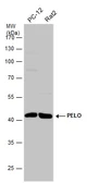 Anti-PELO antibody used in Western Blot (WB). GTX120446
