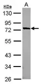 Anti-MUM1L1 antibody [N1N2], N-term used in Western Blot (WB). GTX120472