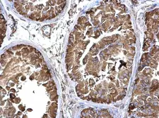 Anti-LZTR2 antibody used in IHC (Paraffin sections) (IHC-P). GTX120599