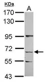 Anti-KLHL13 antibody [N1N2], N-term used in Western Blot (WB). GTX120610