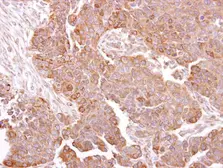 Anti-METTL13 antibody used in IHC (Paraffin sections) (IHC-P). GTX120626
