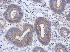 Anti-RAB11FIP3 antibody [C2C3], C-term used in IHC (Paraffin sections) (IHC-P). GTX120640